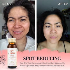 Taut® Anti-Aging Program + Hyaluronic Acid (30 Day Supply)